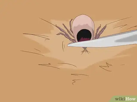 Image titled Remove Ticks from Furry Pets Step 6