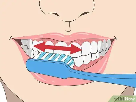 Image titled Avoid Hurting Your Gums Step 8