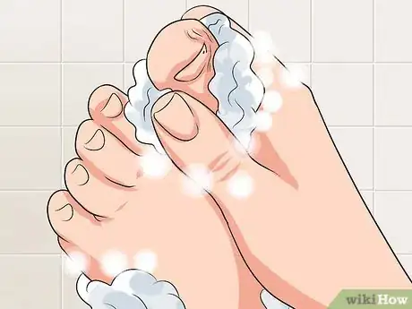 Image titled Remove a Dead Toenail Step 7