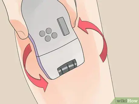 Image titled Epilate Legs Step 9