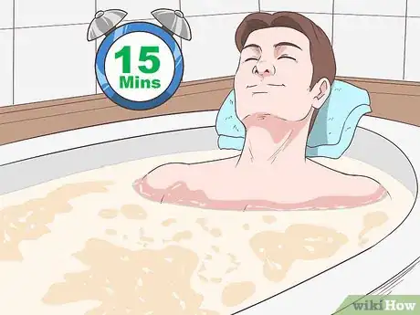 Image titled Care for Psoriasis Step 10
