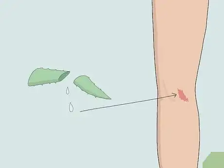 Image titled Heal Skin Naturally Step 5