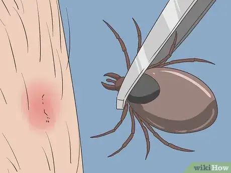 Image titled Prevent Lyme Disease Step 9