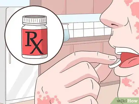 Image titled Achieve Psoriasis Remission Step 4