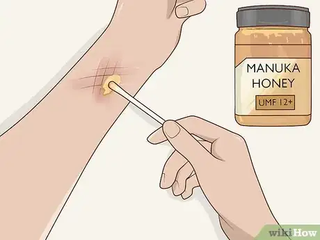 Image titled Use Honey as a Topical Antibiotic Step 1