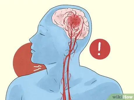 Image titled Stop Neck Cracking Step 4