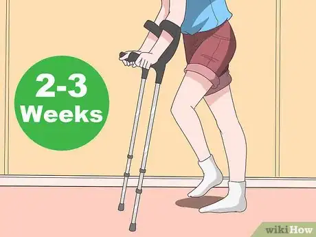 Image titled Treat Achilles Tendon Rupture Step 12