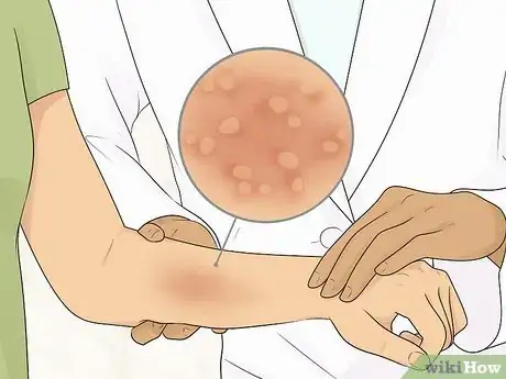 Image titled Avoid Irritation Caused by Natural Skin Care Products Step 12