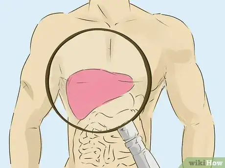Image titled Diagnose Liver Cancer Step 13