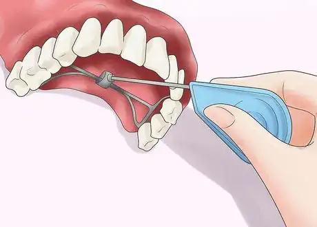 Image titled Check out the herbst appliance