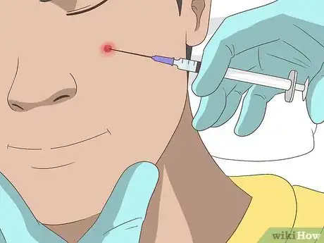 Image titled Shrink Pimples Step 12