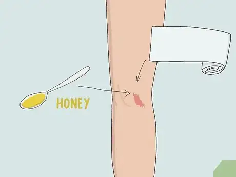Image titled Heal Skin Naturally Step 2