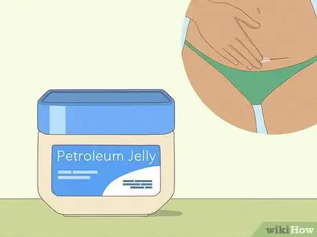 Image titled Lighten a C‐Section Scar Step 6