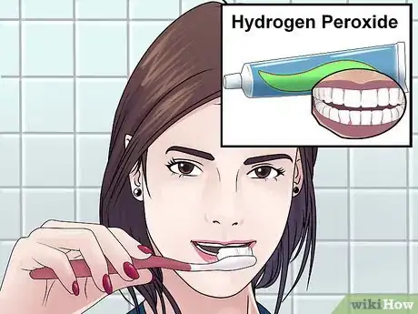Image titled Whiten Teeth With Hydrogen Peroxide Step 1