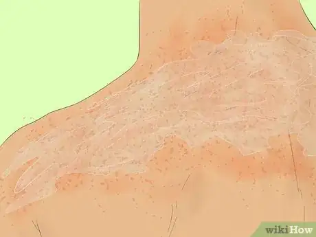 Image titled Use Fresh Aloe Vera Step 5