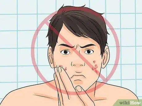 Image titled Control Rosacea Step 6