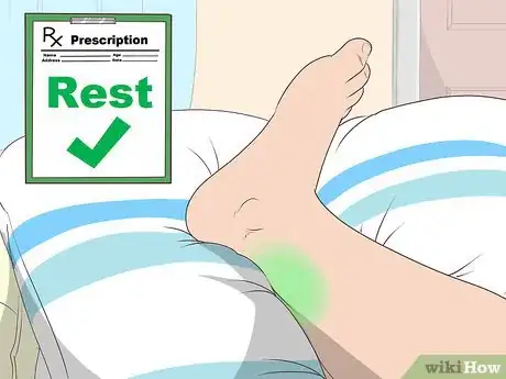Image titled Treat Achilles Tendon Rupture Step 11