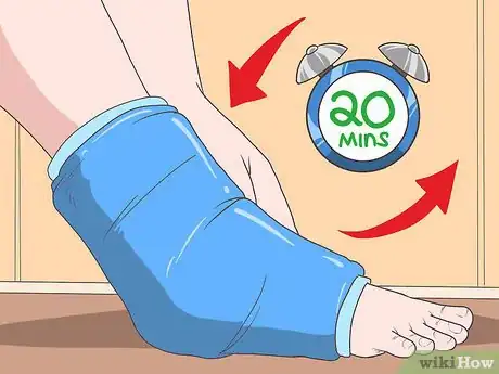 Image titled Return to Running After a Stress Fracture Step 1