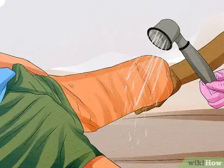 Image titled Care for Your Prosthesis Step 13