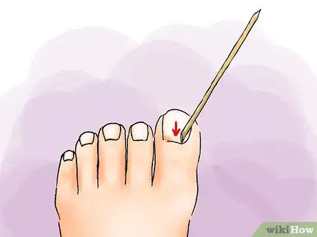 Image titled Get Perfect Feet for Summer Step 06