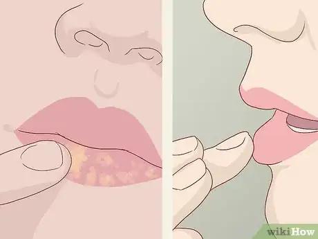 Image titled Fake a Lip Piercing with Makeup Step 1