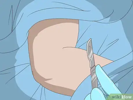 Image titled Treat Rheumatoid Arthritis in the Elbow Step 5