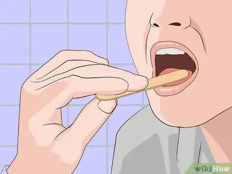 Image titled Avoid Sore Nipples While Breast Feeding Step 15