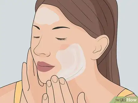 Image titled Clear Up Rosacea Without Medication Step 5