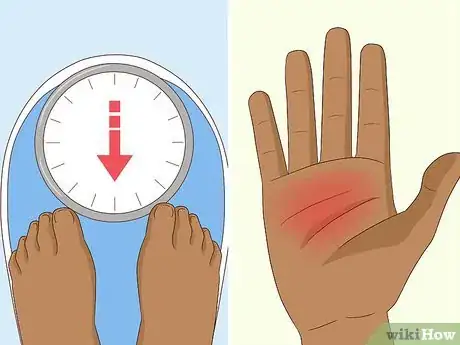 Image titled Find Out if You Have a Vitamin Deficiency Step 4