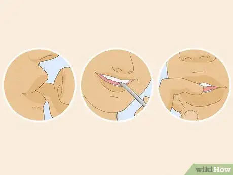 Image titled Fix an Overbite Step 4