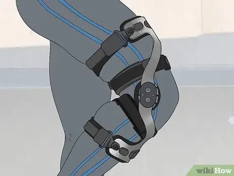 Image titled Treat Anterior Cruciate Ligament (ACL) Tears Step 8