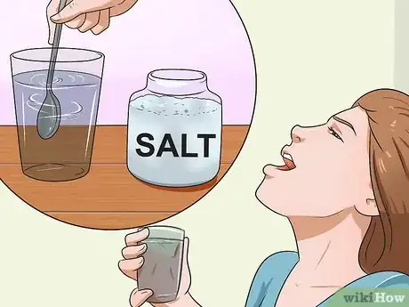 Image titled Cure Post Nasal Drip Step 11