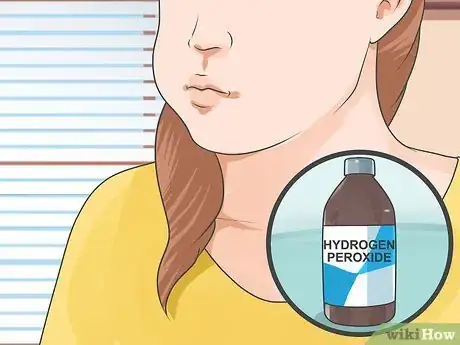 Image titled Get Low Cost Tooth Whitening Step 6