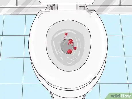 Image titled Stop Rectal Bleeding Step 2