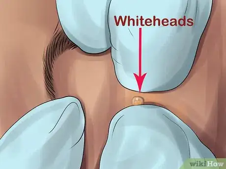 Image titled Choose Between Expert and Diy Beauty Treatments Step 3