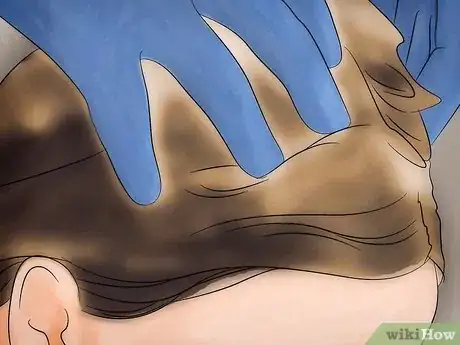 Image titled Free Your Child from Lice Step 7