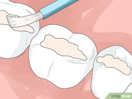 Image titled Keep Kids' Teeth Strong Step 10