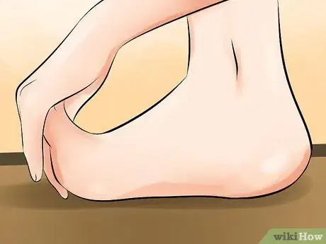 Image titled Recognize Plantar Fasciitis Symptoms Step 21