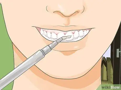 Image titled Get Low Cost Tooth Whitening Step 2