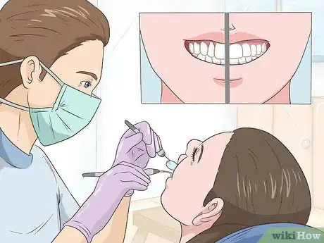Image titled Treat Gingivitis at Home Step 12