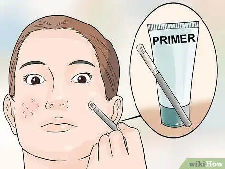Image titled Hide Pimples Step 8