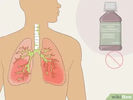 Image titled Clear Chest Congestion Step 16