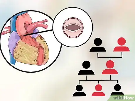 Image titled Find the Cause of Aortic Regurgitation Step 4