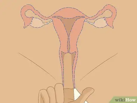 Image titled Use a Cervical Cap Step 3