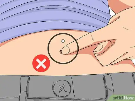 Image titled Treat an Irritated Belly Button Piercing Step 9