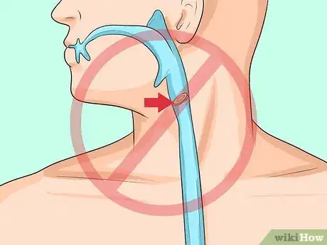 Image titled Prevent Actinomycosis Step 2