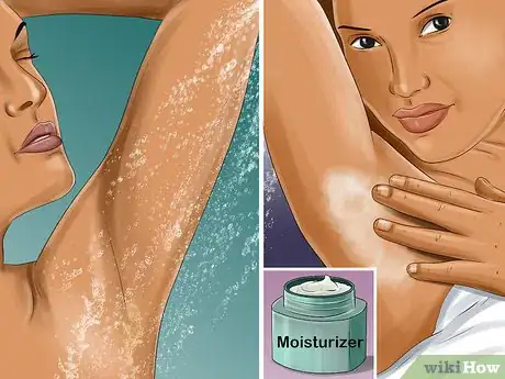 Image titled Prevent Ingrown Hairs on the Pubic Area Step 4