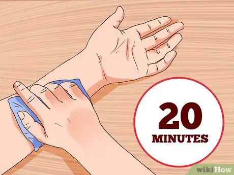 Image titled Apply Cold Therapy Step 18