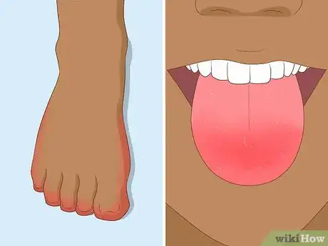 Image titled Find Out if You Have a Vitamin Deficiency Step 9