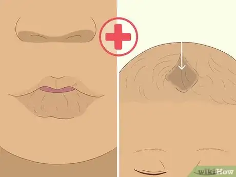 Image titled Treat Diarrhea in Infants Step 9